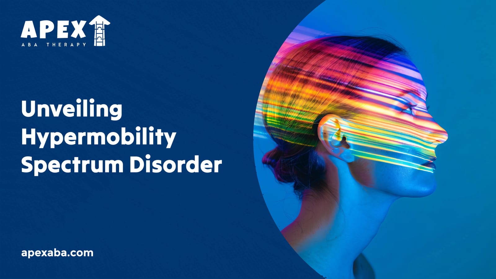 699307c89489a26506e33bdc 666d2f1bffa15a1622e26141 Unveiling%2520Hypermobility%2520Spectrum%2520Disorder 80 jpeg